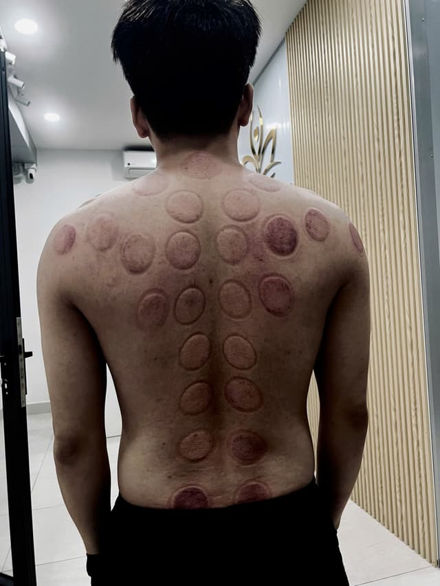 Bằng chứng kiệt sức 1